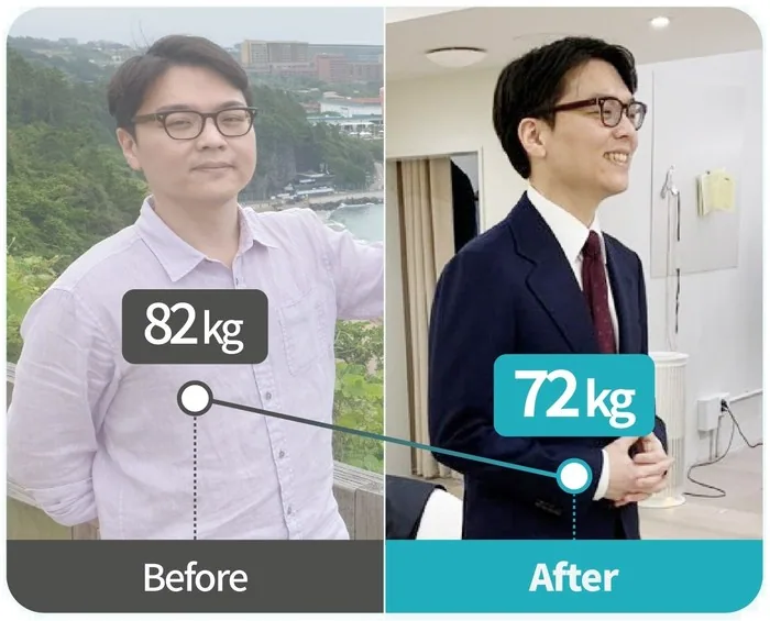 원장 본인 다이어트 전후 82kg에서 72kg 감량
