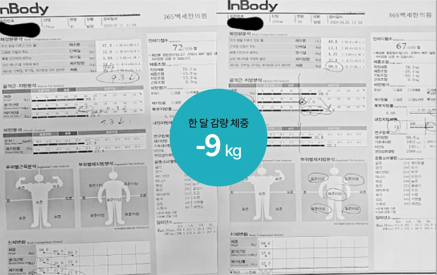 매일감비환 다이어트 실제 감량 후기 1